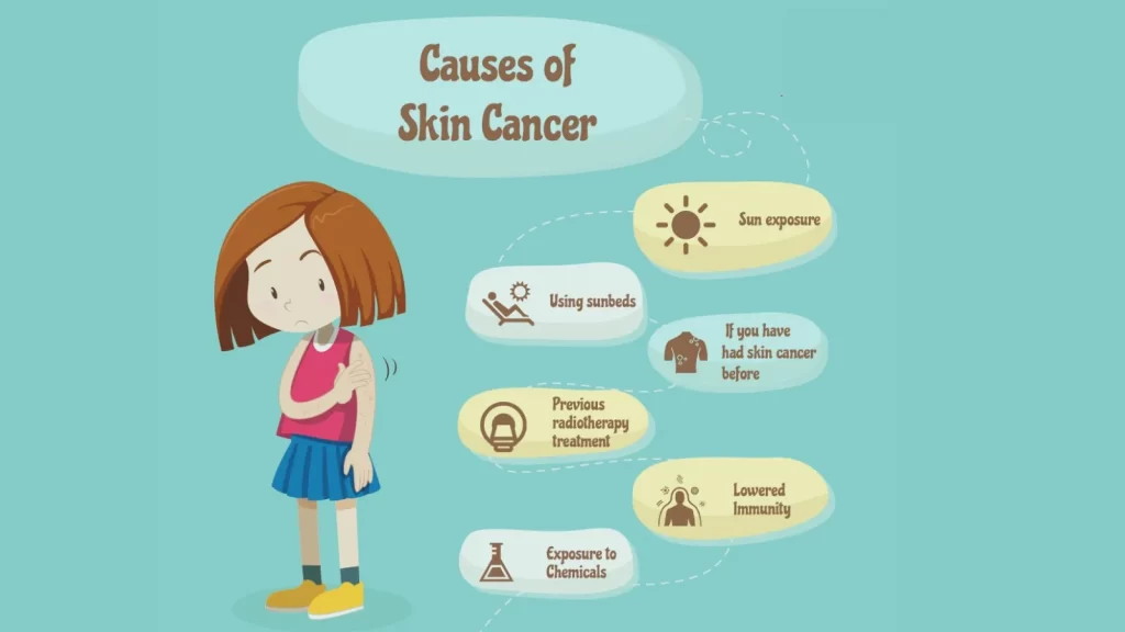 causes-of-skin-cance