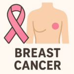 breast-cancer