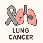 lung-cancer