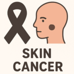skin-cancer